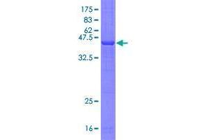 Image no. 1 for Triggering Receptor Expressed On Myeloid Cells 1 (TREM1) (AA 21-234) protein (GST tag) (ABIN1323572)