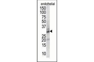 Antibody is used in Western blot to detect DSCR1 in endothelial cell lysate.