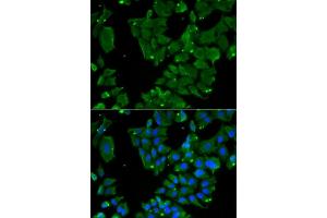 Immunofluorescence analysis of HeLa cells using DBN1 antibody (ABIN6129572, ABIN6139424, ABIN6139425 and ABIN6221983). (DBN1 anticorps  (AA 350-649))
