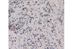 IHC-P analysis of stomach tissue, with DAB staining. (KIR2DL2 anticorps  (AA 22-348))