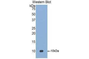 Detection of Recombinant PARC, Human using Polyclonal Antibody to Pulmonary Activation Regulated Chemokine (PARC)