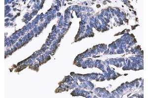 IHC analysis of SUN2 using anti-SUN2 antibody (ABIN7601278). (SUN2 anticorps  (AA 31-695))