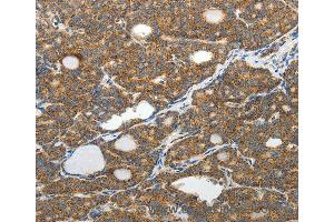 Immunohistochemistry of Human brain using SLC12A4 Polyclonal Antibody at dilution of 1:30