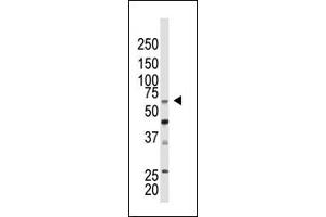 Western Blotting (WB) image for anti-Chromobox Homolog 4 (CBX4) (N-Term) antibody (ABIN357750) (CBX4 anticorps  (N-Term))