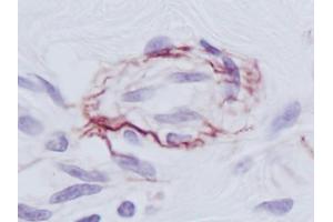 Image no. 1 for anti-PDGF-BB Homodimer antibody (ABIN465590) (PDGF-BB Homodimer anticorps)