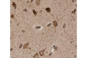ABIN6277923 at 1/50 staining human brain tissue sections by IHC-P. (PINK1 anticorps)