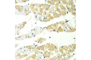Immunohistochemistry of paraffin-embedded mouse heart using TBXAS1 antibody (ABIN6293260) at dilution of 1:100 (40x lens). (TBXAS1 anticorps)