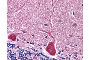 Anti-RWDD3 antibody IHC of human brain, cerebellum.