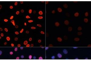 Immunofluorescence analysis of C6 cells using Acetyl-Histone H2B-K5 Polyclonal Antibody at dilution of 1:100.