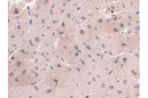 DAB staining on IHC-P; Samples: Human Liver Tissue (HFE2 anticorps  (AA 234-416))