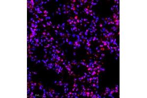 Immunofluorescence of paraffin embedded rat lung using RNF7 (ABIN7075471) at dilution of 1:2000 (400x lens)