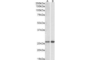 ABIN5539900 (0. (MOBKL3 anticorps  (AA 137-151))