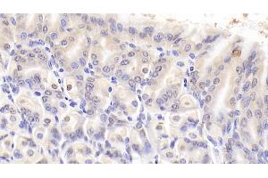 Detection of NCL in Mouse Stomach Tissue using Polyclonal Antibody to Nucleolin (NCL)