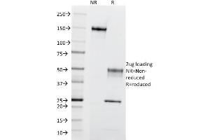 SDS-PAGE Analysis of Purified CD195 Mouse Monoclonal Antibody (12D1). (CCR5 anticorps)