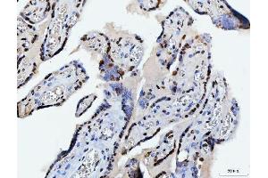IHC analysis of C1orf77/FOP/CHTOP using anti-C1orf77/FOP/CHTOP antibody (ABIN7603201). (CHTOP anticorps  (N-Term))