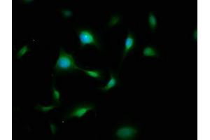 Immunofluorescence staining of U251 cells with ABIN7174025 at 1:200, counter-stained with DAPI. (FYN anticorps  (AA 154-270))