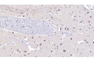 Detection of NT3 in Human Cerebrum Tissue using Polyclonal Antibody to Neurotrophin 3 (NT3) (Neurotrophin 3 anticorps  (AA 130-255))