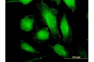 Immunofluorescence of monoclonal antibody to WARS on HeLa cell.