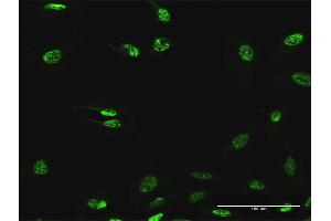 Immunofluorescence of purified MaxPab antibody to ABHD11 on HeLa cell. (ABHD11 anticorps  (AA 1-315))