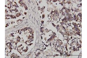Image no. 1 for anti-Fragile X Mental Retardation, Autosomal Homolog 1 (FXR1) (AA 121-220) antibody (ABIN599029) (FXR1 anticorps  (AA 121-220))