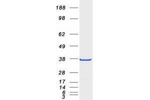 Validation with Western Blot