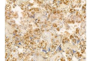 ABIN6261735 and ABIN6266539 at 1/100 staining human normal placenta tissue by IHC-P.