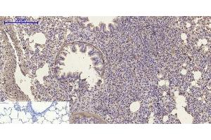Immunohistochemistry of paraffin-embedded Rat lung tissue using α-SMA Polyclonal Antibody at dilution of 1:200. (alpha-SMA anticorps)