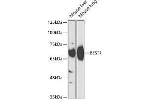 Western blot analysis of extracts of various cell lines, using BEST1 antibody (ABIN6127515, ABIN6137534, ABIN6137536 and ABIN6218300) at 1:1000 dilution. (Bestrophin 1 anticorps  (AA 376-585))