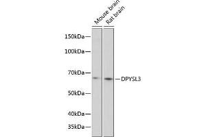 Western blot analysis of extracts of various cell lines, using DPYSL3 Polyclonal Antibody (ABIN6130137, ABIN6139811, ABIN6139812 and ABIN6215891) at 1:1000 dilution. (DPYSL3 anticorps  (AA 1-280))