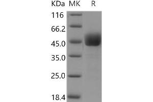 Western Blotting (WB) image for CD3d Molecule, delta (CD3-TCR Complex) (CD3D) protein (Fc Tag) (ABIN7320294)