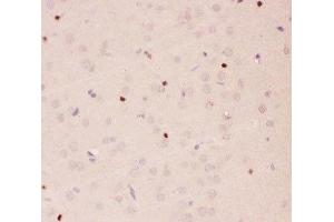 IHC-P staining of rat brain tissue (APEX1 anticorps  (AA 2-318))