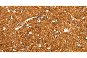 Immunohistochemistry of paraffin-embedded Human brain tissue using SLC4A4 Polyclonal Antibody at dilution 1:50