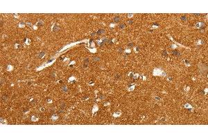 Immunohistochemistry of paraffin-embedded Human brain tissue using SLC4A4 Polyclonal Antibody at dilution 1:50 (SLC4A4 anticorps)