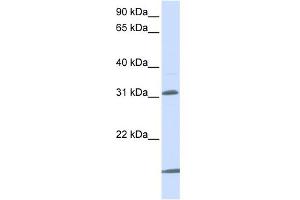 WB Suggested Anti-SLC25A11 Antibody Titration:  0.