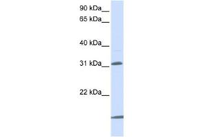 WB Suggested Anti-SLC25A11 Antibody Titration:  0. (SLC25A11 anticorps  (N-Term))