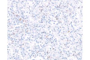 Immunohistochemistry (IHC) image for anti-Interleukin 7 Receptor (IL7R) (AA 21-236) antibody (ABIN7453897) (Recombinant IL7R anticorps  (AA 21-236))