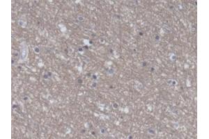 Detection of EEF2 in Human Cerebrum Tissue using Polyclonal Antibody to Eukaryotic Translation Elongation Factor 2 (EEF2)