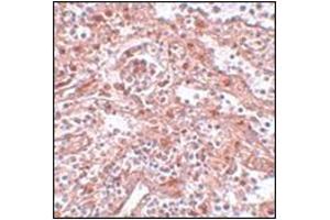 Immunohistochemistry of KLF4 in human spleen tissue AP30509PU-N antibody at 5 μg/ml. (LIN28A anticorps  (C-Term))