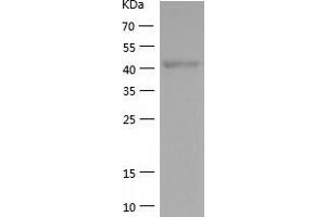 Western Blotting (WB) image for YY1 Transcription Factor (YY1) (AA 1-414) protein (His-IF2DI Tag) (ABIN7125763)