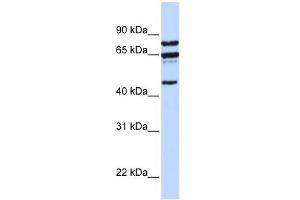 WB Suggested Anti-PPP4R2 Antibody Titration:  0. (PPP4R2 anticorps  (C-Term))