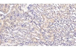 Detection of C4B in Mouse Kidney Tissue using Polyclonal Antibody to Complement C4-B (C4B)