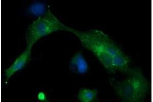 Image no. 3 for anti-Melan A (MLANA) antibody (ABIN1499426) (MLANA anticorps)