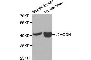 Western blot analysis of extracts of various cell lines, using L2HGDH antibody (ABIN5975242) at 1/1000 dilution. (L2HGDH anticorps)