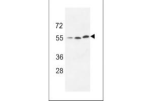 Western blot analysis of anti-URKL1 Pab (ABIN391288 and ABIN2841330) in 293 cell line lysate (35 μg/lane). (UCKL1 anticorps  (N-Term))