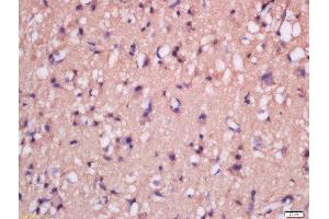Formalin-fixed and paraffin embedded rat brain tissue labeled with Anti-MSRB2 Polyclonal Antibody, Unconjugated  at 1:300 followed by conjugation to the secondary antibody and DAB staining