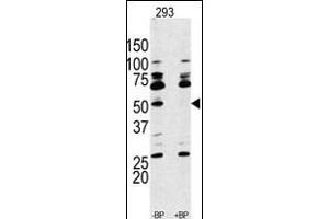 Western blot analysis of anti-RPS6KB1 Antibody (Center) Pab (ABIN389685 and ABIN2839654) pre-incubated with and without blocking peptide (BPNULL) in 293 cell line lysate. (RPS6KB1 anticorps  (AA 277-306))