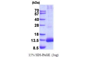 SDS-PAGE (SDS) image for Peptidase Inhibitor 3, Skin-Derived (PI3) (AA 23-117) protein (His tag) (ABIN5778834) (PI3 Protein (AA 23-117) (His tag))
