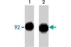 Western blot analysis of CTNNB1 immunoprecipitated from A-431 cells treated with pervanadate. (CTNNB1 anticorps  (C-Term))