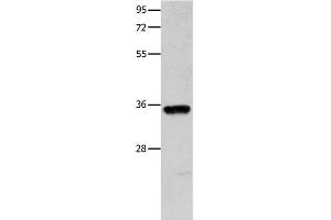 Western Blot analysis of Mouse brain tissue using COX11 Polyclonal Antibody at dilution of 1:600 (COX11 anticorps)