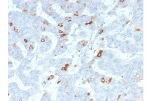 Formalin-fixed, paraffin-embedded human Colon stained with MUC2 Rabbit Recombinant Monoclonal Antibody (MLP/2970R). (Recombinant MUC2 anticorps)